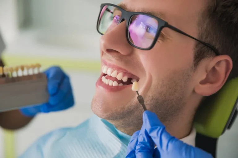 man smile with healthy teeth whitening. Dental care concept. Set of implants with various shades of tone