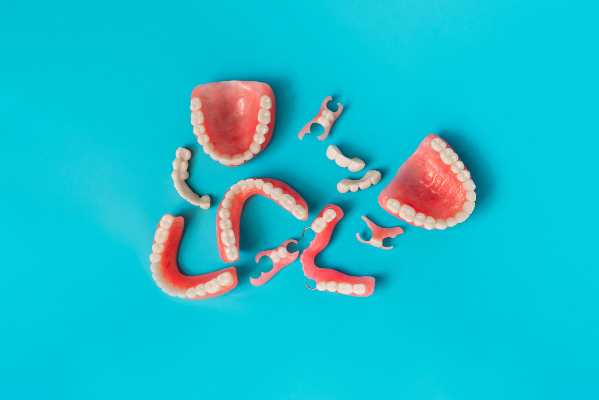 Dental prosthetics on a blue background. Dentures. Prosthetic teeth. False teeth. Prosthetic dentistry. Set of dentures on a blue background. Top view of complete denture on blue background