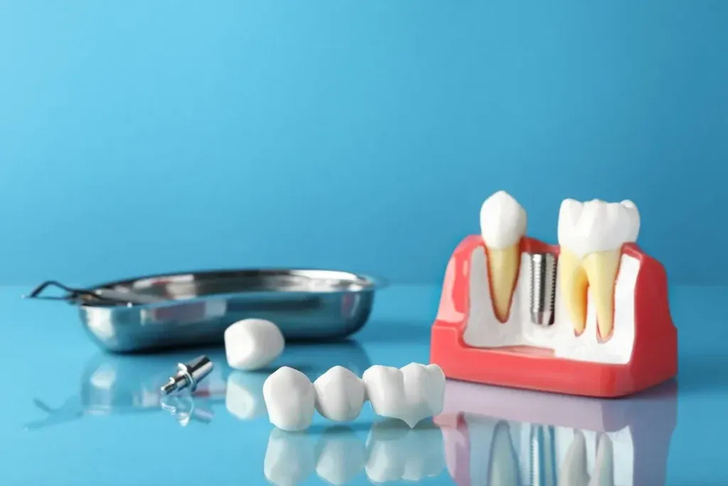Dental bridge near educational model of gum with implant on light blue background.